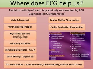 Where does ECG help us?
Electrical Activity of Heart is graphically represented by ECG
(Sophisticated Galvanometer)
Atrial Enlargement
Ventricular Hypertrophy
Myocardial Ischemia
Nonspecific ST T changes
Unstable Angina / STEMI
Cardiac Rhythm Abnormalities
Metabolic Disturbance – Ca / K
Effect of drugs – Digoxin etc
ECG abnormalities : Acute Pericarditis, Cardiomyopathy, Valvular Heart Disease
Pulmonary Embolism
Cardiac Conduction Abnormalities
 