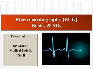 Presented by:
Dr. Madah
Medical Unit 2,
SGRH
Electrocardiography (ECG)
Basics & MIs
 