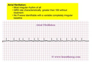 student notes on Electrocardiography ECG.ppt