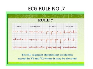 ELECTRO CARDIO GRAPHY (ECG) ppt.pptx