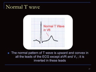 Normal T Wave Parameters Electrocardiography for Students | PPTX