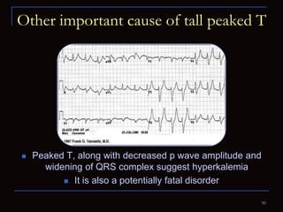 Peaked R Complex Electrocardiography for Students | PPTX