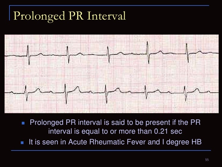 Electrocardiography for Students