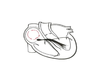 Electrocardiography II.pptx interpretation and analysing ecg strips | PPTX