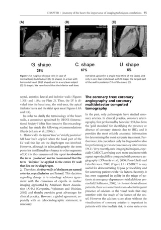 Electrocardiography In Ischaemic Heart Disease Clinical And Imagine ...