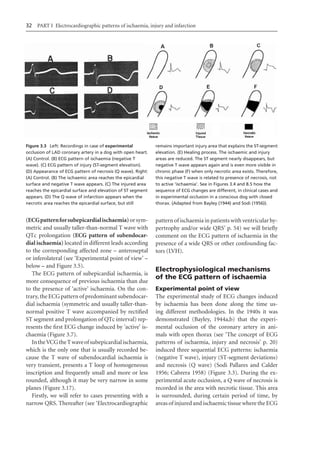 Electrocardiography In Ischaemic Heart Disease Clinical And Imagine ...