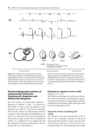 Electrocardiography In Ischaemic Heart Disease Clinical And Imagine ...