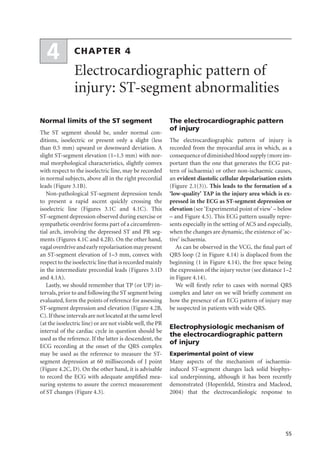 Electrocardiography In Ischaemic Heart Disease Clinical And Imagine ...