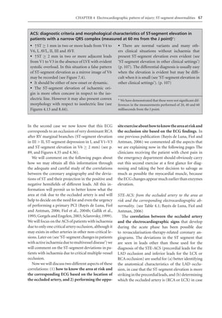 Electrocardiography In Ischaemic Heart Disease Clinical And Imagine ...