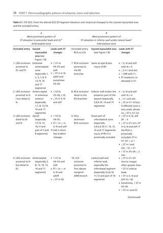 Electrocardiography In Ischaemic Heart Disease Clinical And Imagine ...