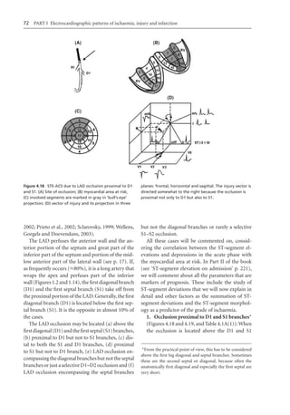 Electrocardiography In Ischaemic Heart Disease Clinical And Imagine ...