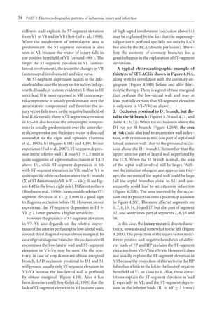Electrocardiography In Ischaemic Heart Disease Clinical And Imagine ...