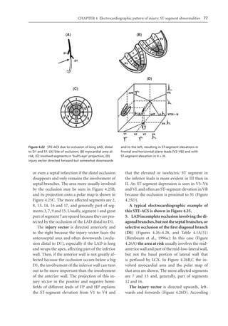 Electrocardiography In Ischaemic Heart Disease Clinical And Imagine ...