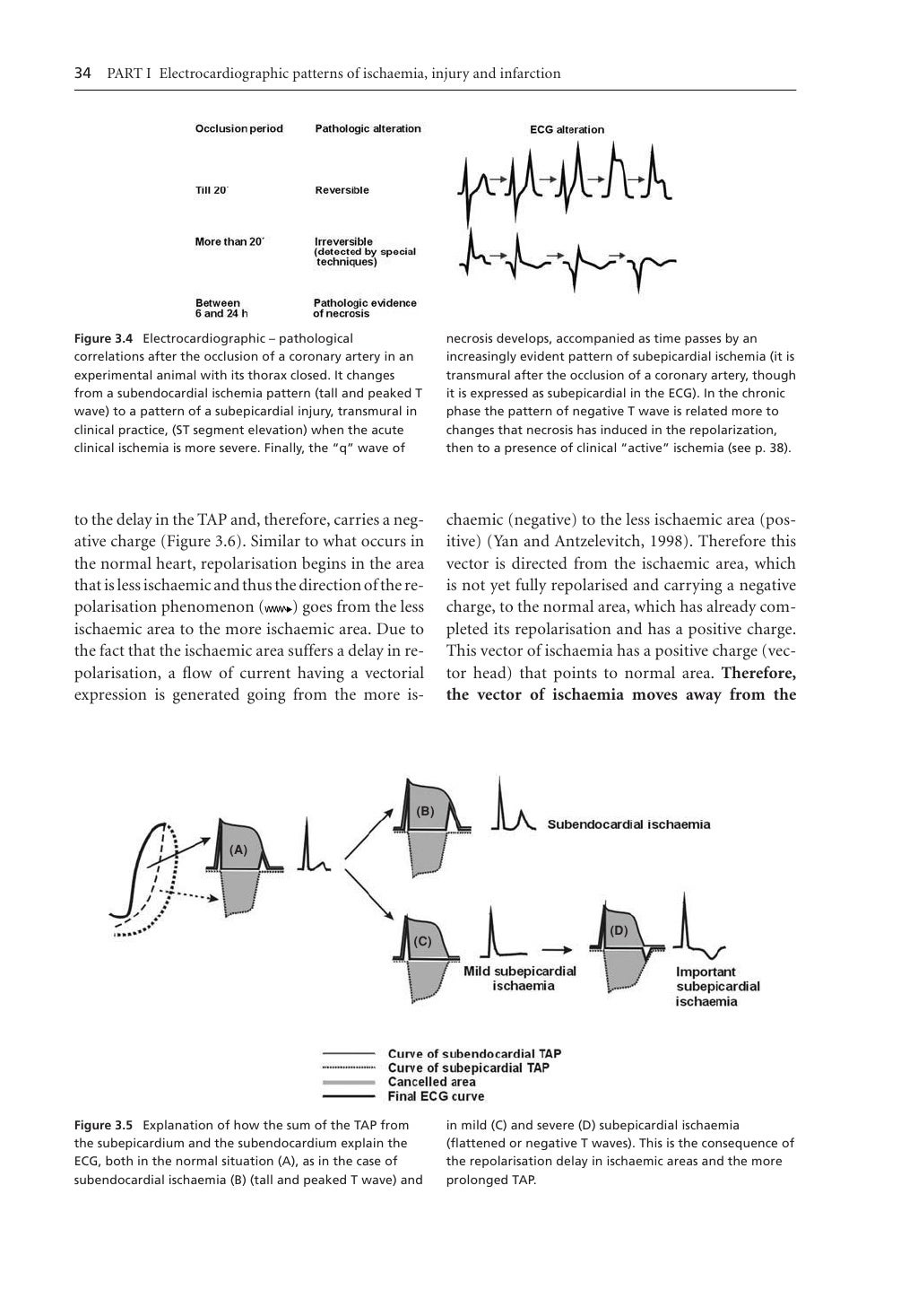 Electrocardiography In Ischaemic Heart Disease Clinical And Imagin…