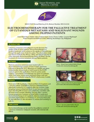Electrochemotherapy for the palliative treatment of skin metastases and malignant wounds among filipino patients