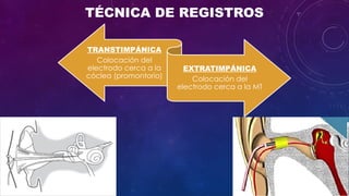 Cleograph Electrocochleography: Clinical Applications and Diagnostic Techniques ...
