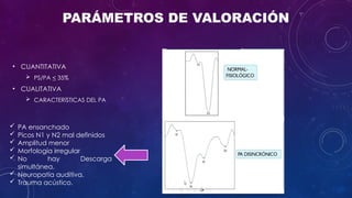 Cleograph Electrocochleography: Clinical Applications and Diagnostic Techniques ...