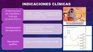 Cleograph Electrocochleography: Clinical Applications and Diagnostic Techniques ...