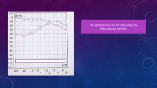 Cleograph Electrocochleography: Clinical Applications and Diagnostic Techniques ...