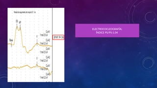 Cleograph Electrocochleography: Clinical Applications and Diagnostic Techniques ...