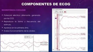 Cleograph Electrocochleography: Clinical Applications and Diagnostic Techniques ...