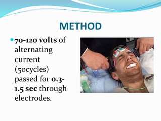 METHOD
70-120 volts of
alternating
current
(50cycles)
passed for 0.3-
1.5 sec through
electrodes.
 
