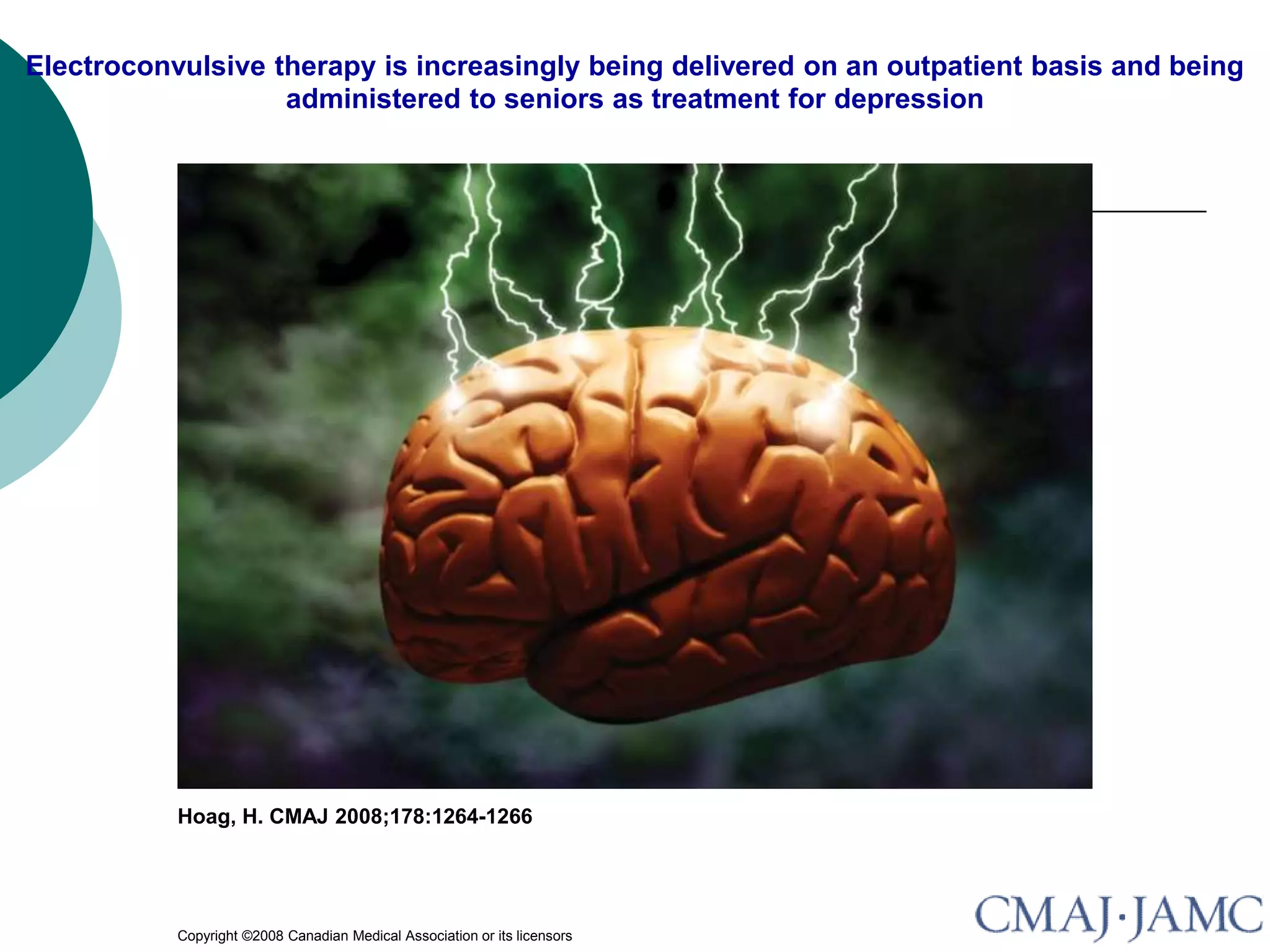 Electroconvulsive-Therapy.ppt
