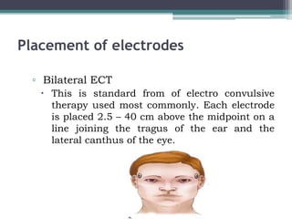 Placement of electrodes
▫ Bilateral ECT
 This is standard from of electro convulsive
therapy used most commonly. Each electrode
is placed 2.5 – 40 cm above the midpoint on a
line joining the tragus of the ear and the
lateral canthus of the eye.
 
