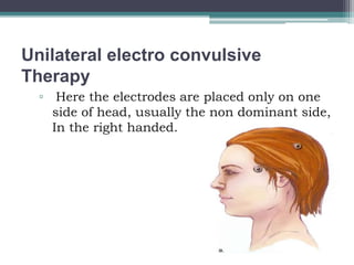 Unilateral electro convulsive
Therapy
▫ Here the electrodes are placed only on one
side of head, usually the non dominant side,
In the right handed.
 