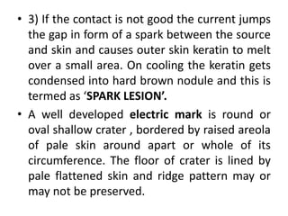 • 3) If the contact is not good the current jumps
the gap in form of a spark between the source
and skin and causes outer skin keratin to melt
over a small area. On cooling the keratin gets
condensed into hard brown nodule and this is
termed as ‘SPARK LESION’.
• A well developed electric mark is round or
oval shallow crater , bordered by raised areola
of pale skin around apart or whole of its
circumference. The floor of crater is lined by
pale flattened skin and ridge pattern may or
may not be preserved.
 