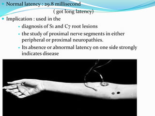  Normal latency : 29.8 millisecond
                        ( got long latency)
 Implication : used in the
        diagnosis of S1 and C7 root lesions

        the study of proximal nerve segments in either
         peripheral or proximal neuropathies.
        Its absence or abnormal latency on one side strongly
         indicates disease
 
