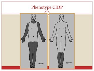 Phenotype CIDP
 