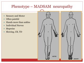 Phenotype – MADSAM neuropathy
 Sensory and Motor
 Often painful
 Hands more than ankles
 Individual Nerves
 Stepwise
 Slowing, CB, TD
 