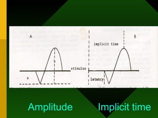 Amplitude  Implicit time 