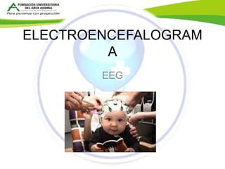 ELECTROENCEFALOGRAM 
A 
EEG 
 