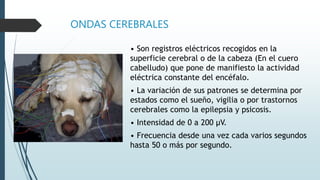 ELECTROENCEFALOGRAMA.pptx