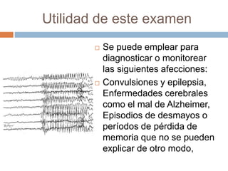 Utilidad de este examen
 Se puede emplear para
diagnosticar o monitorear
las siguientes afecciones:
 Convulsiones y epilepsia,
Enfermedades cerebrales
como el mal de Alzheimer,
Episodios de desmayos o
períodos de pérdida de
memoria que no se pueden
explicar de otro modo,
 