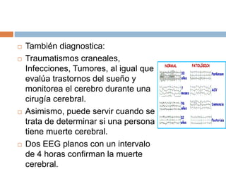  También diagnostica:
 Traumatismos craneales,
Infecciones, Tumores, al igual que
evalúa trastornos del sueño y
monitorea el cerebro durante una
cirugía cerebral.
 Asimismo, puede servir cuando se
trata de determinar si una persona
tiene muerte cerebral.
 Dos EEG planos con un intervalo
de 4 horas confirman la muerte
cerebral.
 