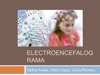 ELECTROENCEFALOG
RAMA
Yadira Avalos, Karol López, Laura Romero.
 