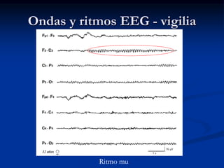 Ondas y ritmos EEG - vigilia
Ritmo mu
 