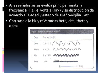  A las señales se les evalúa principalmente la
  frecuencia (Hz), el voltaje (mV) y su distribución de
  acuerdo a la edad y estado de sueño-vigilia…etc
 Con base a la Hz y mV: ondas beta, alfa, theta y
  delta
 
