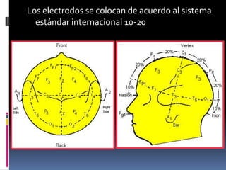 Los electrodos se colocan de acuerdo al sistema
  estándar internacional 10-20
 