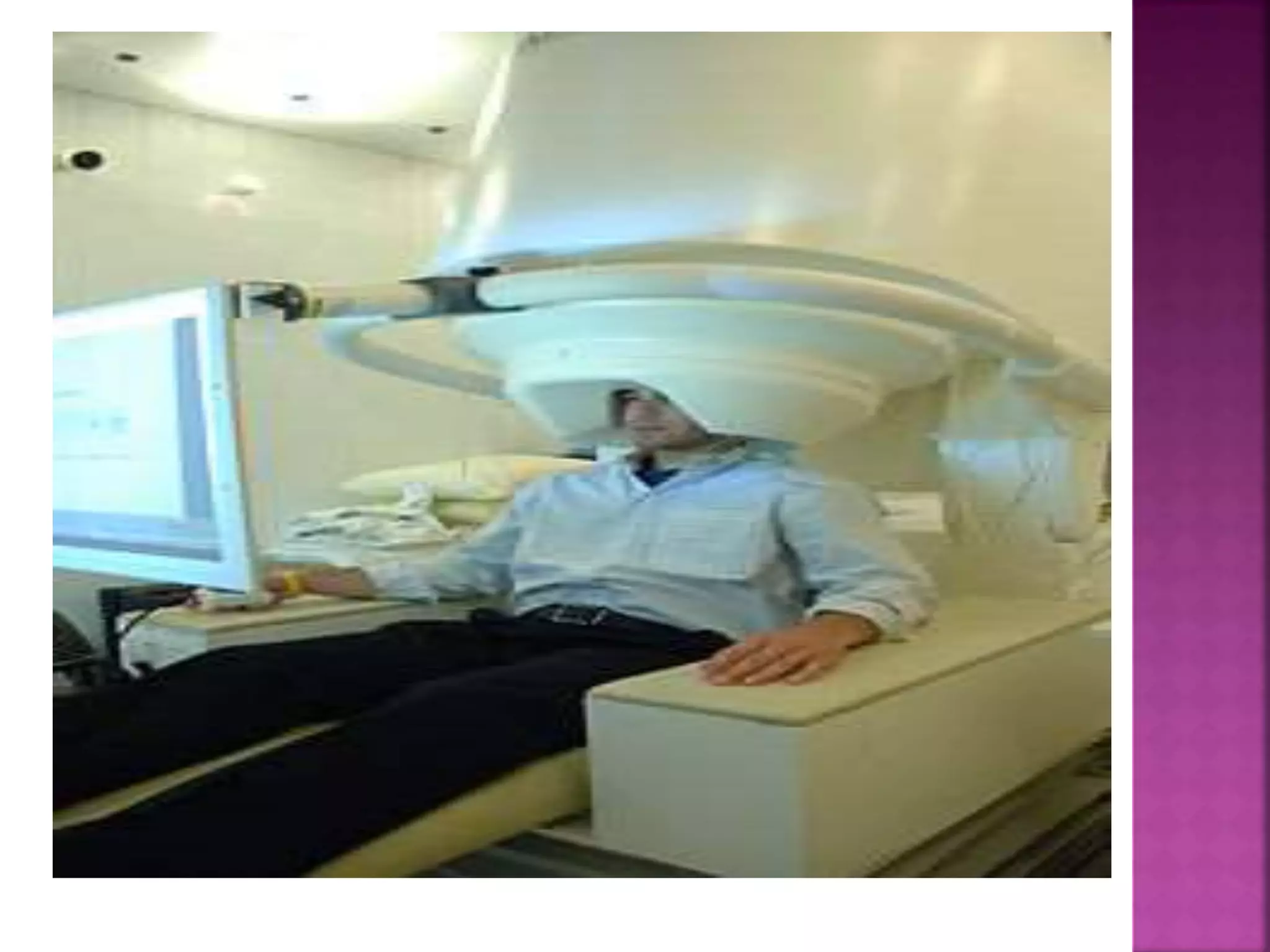 Electroencephal ogram (eeg)