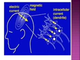 Electroencephal ogram (eeg)