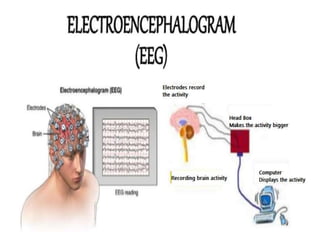 EEG | PPT