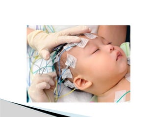 Importance of Electroencephalogram (EEG)