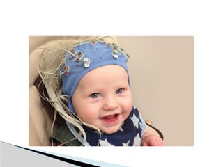 Importance of Electroencephalogram (EEG)