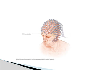 Importance of Electroencephalogram (EEG)