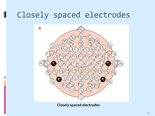 Closely spaced electrodes
Closely spaced electrodes
9
 