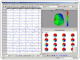 Electroencephalography | PPTX